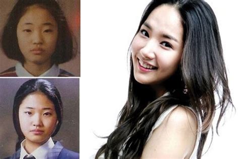 Park Min Young Plastic Surgery Before And After Pictures 2023