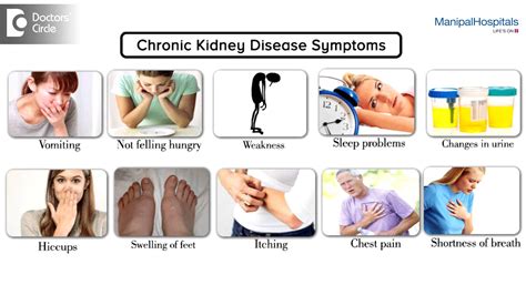 What Are The Symptoms Of Chronic Kidney Disease Health Watch Channel