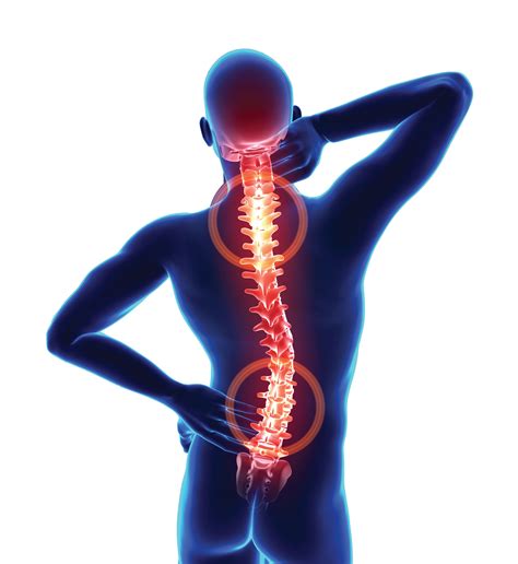 What Are Some Common Causes Of Back And Neck Pain Sentara Martha