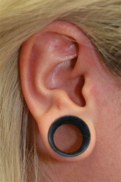 Life After Gauges Everything You Need To Know About Earlobe Repair