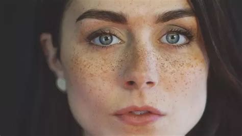How To Lighten Freckles Quora