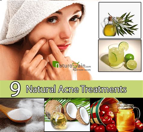 Natural Acne Treatment Treat Acne With These 9 Natural Cures