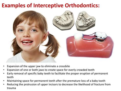 Ppt Interceptive Orthodontic Treatment Interceptive Orthodonti Powerpoint Presentation Id
