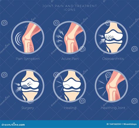 Set Of Icons Of The Joints And Their Treatment Cartilage Damage