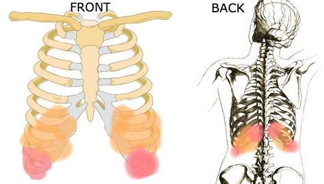 Organ Under The Rib Back On The Right Side Intercostal Neuralgia