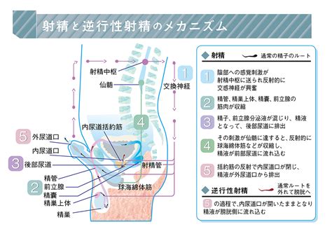 射精障害 もっと知ってほしいがんと生活のこと