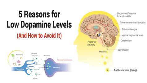 5 Reasons For Low Dopamine Levels And How To Avoid It