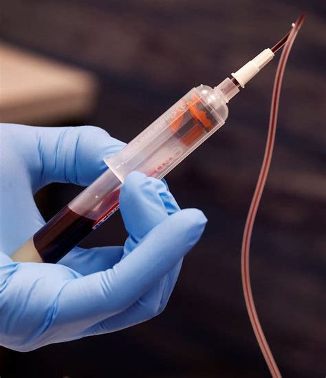Blood Samples Vital For Antibody Tests Sold At Exorbitant Rates The