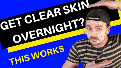 Overnight Face Mask For Clear Skin Acne Chris Gibson Youtube