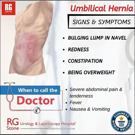 Umbilical Hernia Umbilical Hernia Hernia Repair Hernia Symptoms