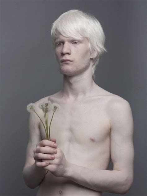 Albino Model Albino Men Albino