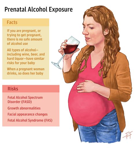 Prenatal Alcohol Exposure No Safe Amount Patient Information Jama