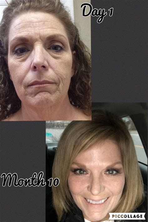 My Day 1 And Month 10 Results Nerium Night And Day Creams Consistent
