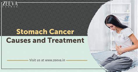 Stomach Cancer Causes And Treatment Cancer Specialist Zeeva Clinic