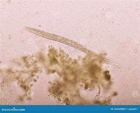 Strongyloides Stercoralis Or Threadworm In Human Stool Royalty Free