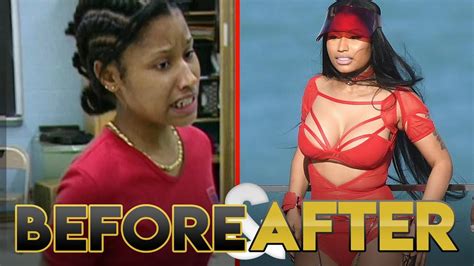 Nicki Minaj Before And After Transformation Plastic Surgery Makeup