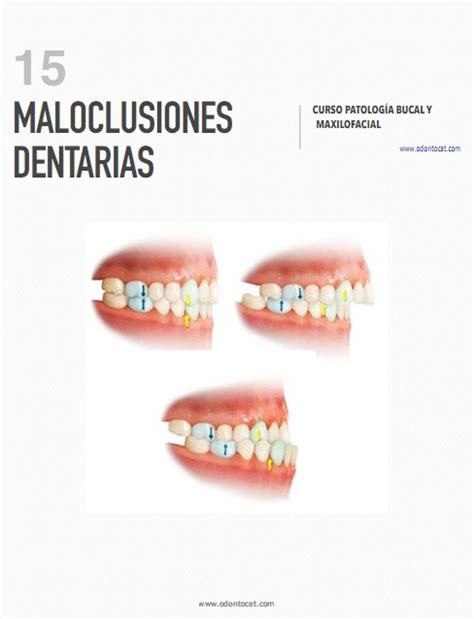 Odontocat Curso Online De Patología Bucal Y Maxilofacial