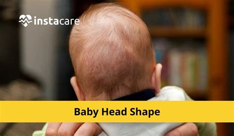 When To Worry About Your Babys Head Shape