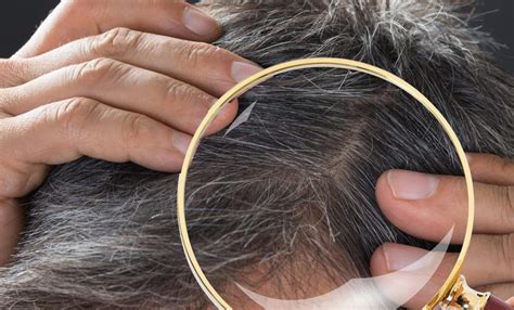 Just as permanent hair fall can have a number of different causes, so too can. Hair Loss vs. Hair Shedding - Miami Hair Institute