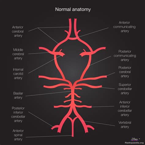 The Circle Of Willis Is An Arterial Polygon Formed As The Internal