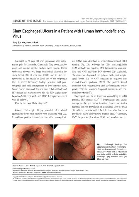 Pdf Giant Esophageal Ulcers In A Patient With Human Immunodeficiency