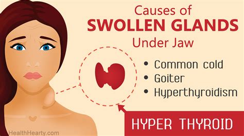 Swollen Glands Under Jaw Health Hearty