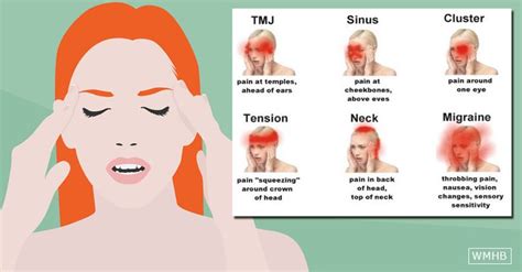 6 Headache Types How To Recognize Which Ones Are Dangerous