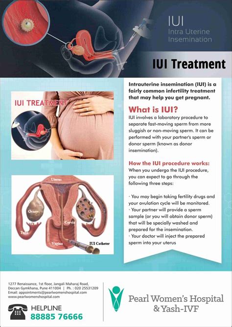 However, the sperms still have to swim some length of the fallopian tubes to reach the egg and. Pin on IUI treatment