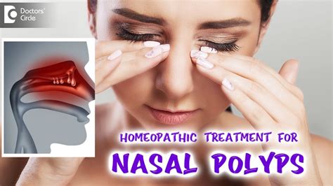 Nasal Polyps Best Homeopathic Treatment Dr V Bhagyalakshmi