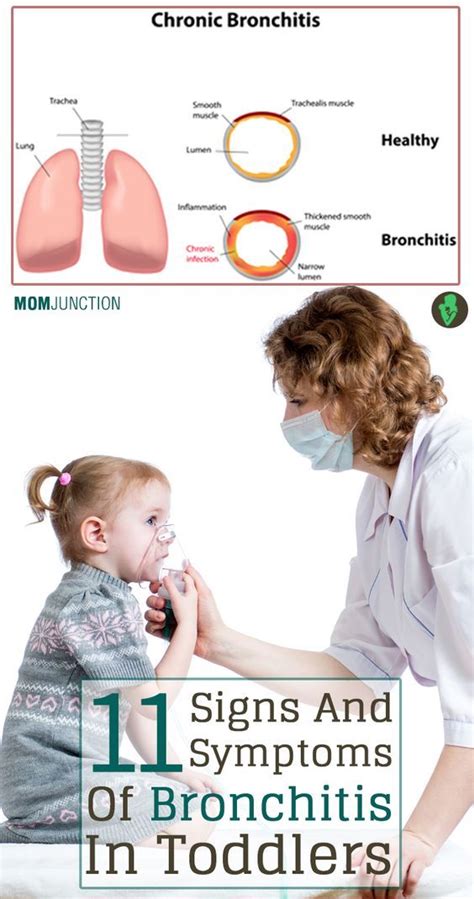 10 Bronchitis In Babies Treatment Ideas Babbiesxc
