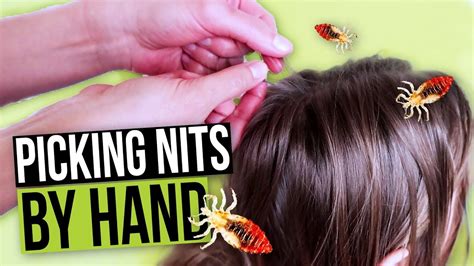 Nit Picking By Hand How To Pick Nits And Lice Eggs Out Of Hair Youtube