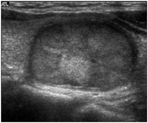 Pin On Thyroide