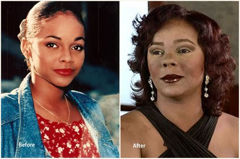 Top 10 Worst Celebrity Plastic Surgery Disasters From Hollywood Why Cef