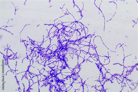 Bacillus Is A Genus Of Gram Positive Rod Shaped Bacteria And A Member