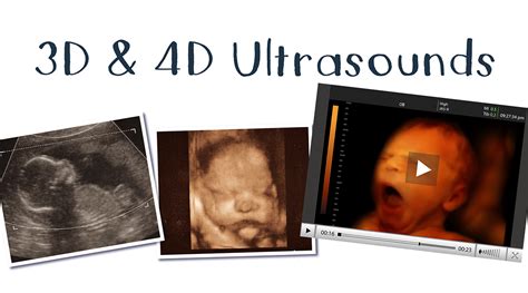 What Is A 4d Ultrasound Scan Importance And How It Works Vlrengbr
