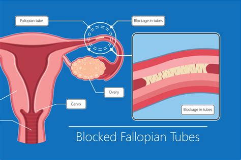 Fallopian Tube Diagram Egg