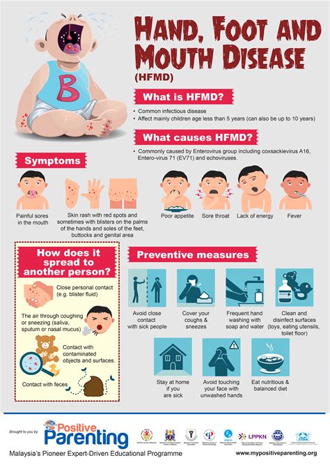 It typically begins with a fever and feeling generally unwell. Hand, Foot and Mouth Disease (HFMD) - Positive Parenting