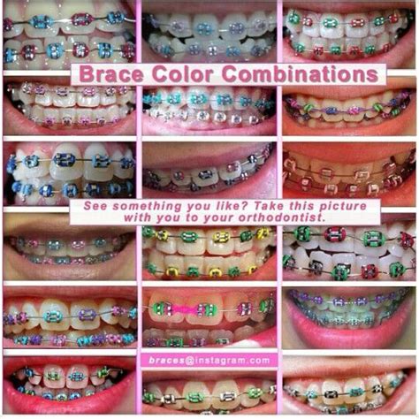 Color Combinations Cute Braces Colors Cute Braces Braces Teeth Colors