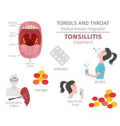 Tonsils And Throat Diseases Peritonsillar Abscess Vector Image The Best Porn Website