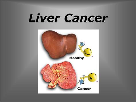 Ppt Liver Cancer Powerpoint Presentation Free Download Id6399378