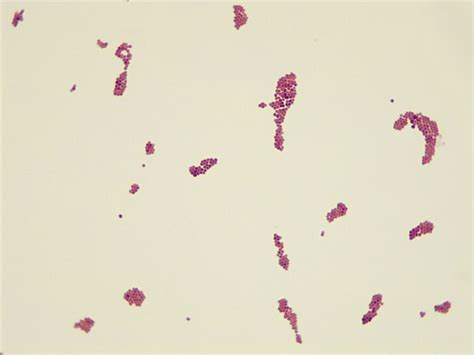 Micrograph Neisseria Sicca Gram Stain X P Oer Commons