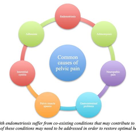 Pathogenetic implications of the anatomic distribution. Is My Pelvic Pain Endometriosis? | Vital Health ...