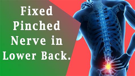 Pinched Nerve In Lower Back How To Fixed Pinched Nerve In Lower Back Youtube