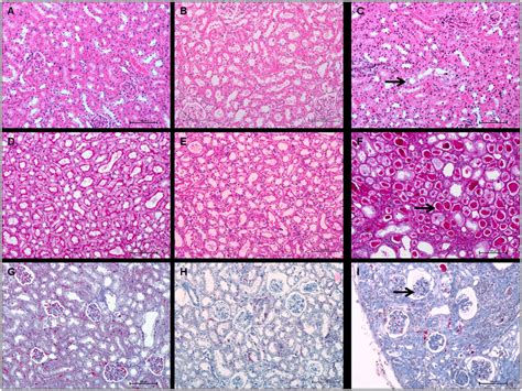 Kidney Histology Of Control And 213bi Bsa Injected Mice Comparison