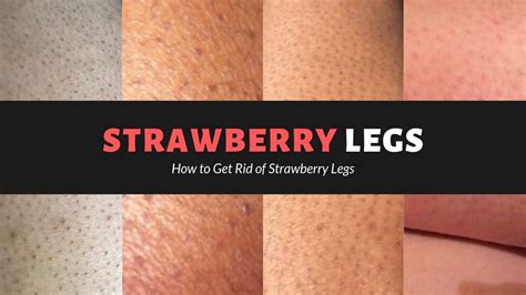 Fastest Way To Get Rid Of Strawberry Legs