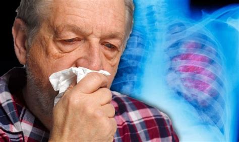 Lung Cancer Symptoms Signs Of A Tumour Include Blood In Mucus
