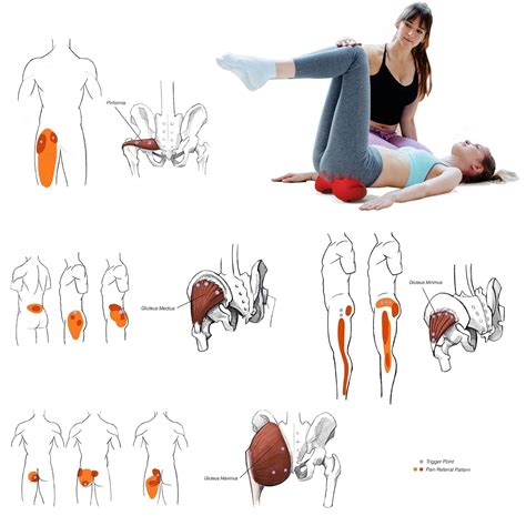 Oit Latissimus Dorsi Trigger Points Latissimus Dorsi Back Muscles My