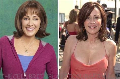 Patricia Heaton Plastic Surgery Is True Or Not The