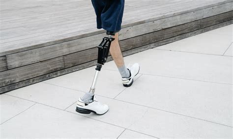 How To Walk On Your New Prosthetic Leg Alcam Medical Orthotics And