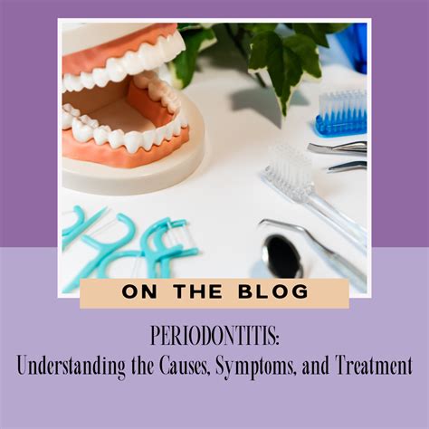 Periodontitis Understanding The Causes Symptoms And Treatment